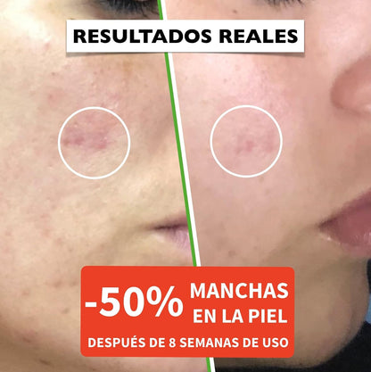 Suero Facial Orgánico Vitamina C Y Ácido Hialurónico Puro – Remueve Cicatrices De Acné, Manchas De Piel - Efecto anti Edad - Sérum BIO - Antiarrugas Illuminante Natural Para Rostro Y Cuello - 60Ml